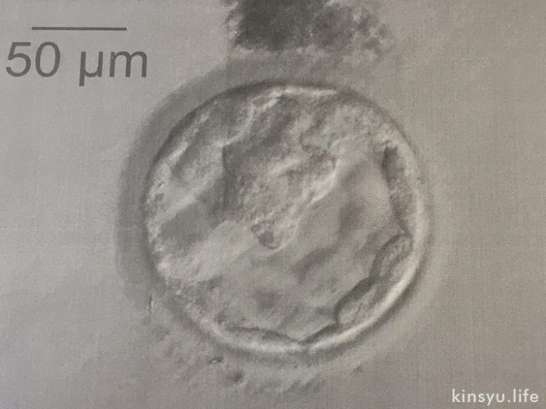 4AAの胚盤胞