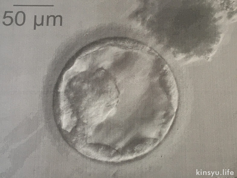4ABの胚盤胞